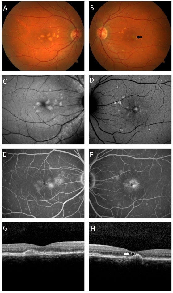 CAPV Optometria - Muitas doenças afetam a região dos olhos